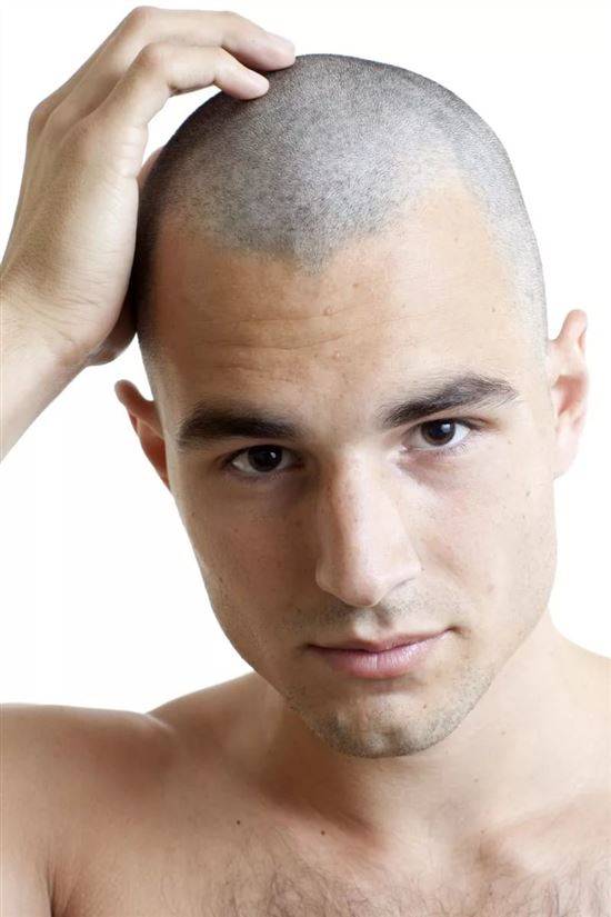 Полезно ли брить голову налысо для роста волос